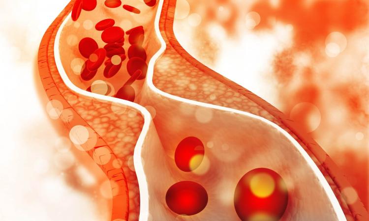 best ayurvedic center for metabolic syndrome in Dubai,