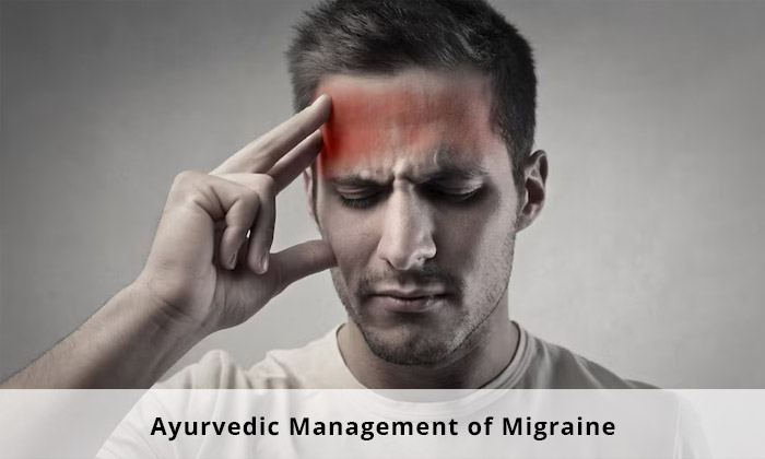 AYURVEDIC MANAGEMENT OF MIGRAINE